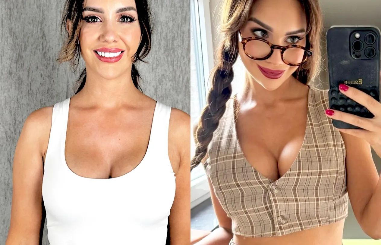 Breast Implant Revision — before and after