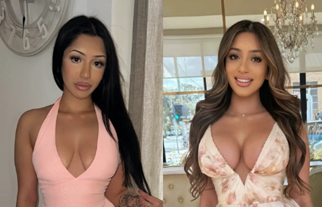 Breast Augmentation — before and after