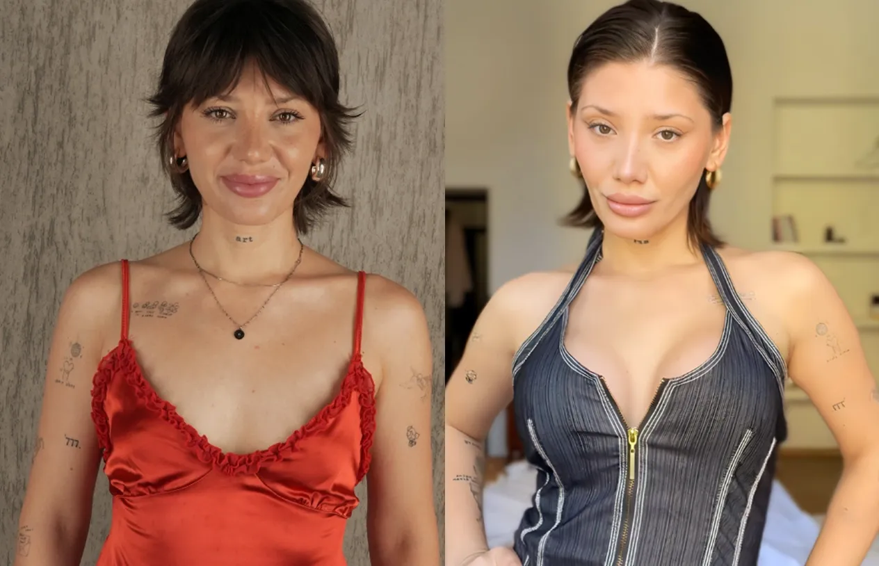 Breast Augmentation — before and after