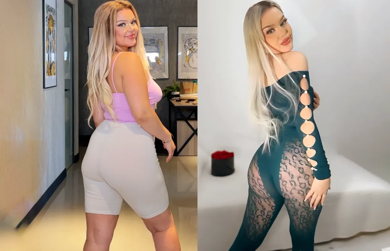 Brazilian Butt Lift — before and after