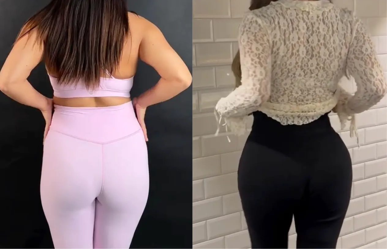 Brazilian Butt Lift — before and after