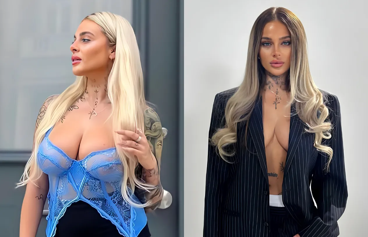 Breast Lift — before and after