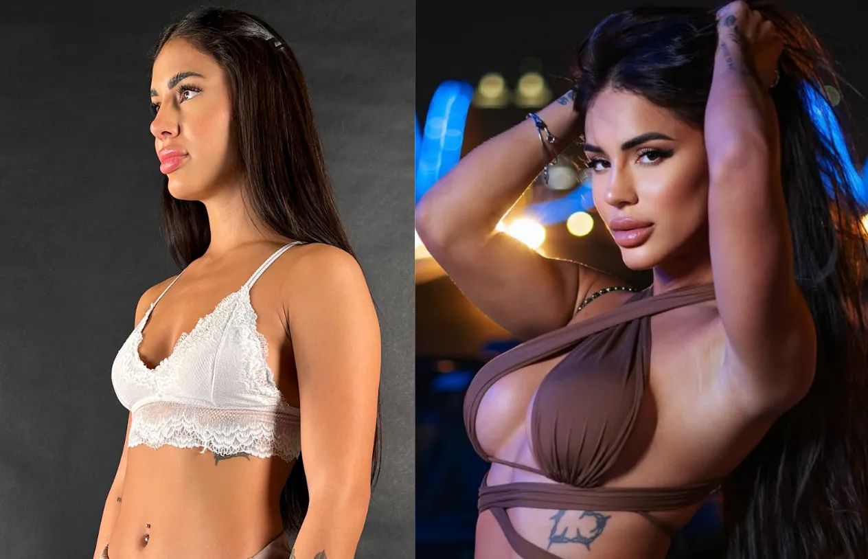 Breast Augmentation — before and after